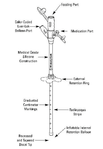 Picture of Mic-Key Tube Gastronomy Feeding Tubes, Adult, Internal Retention Balloon, Secur-Lok