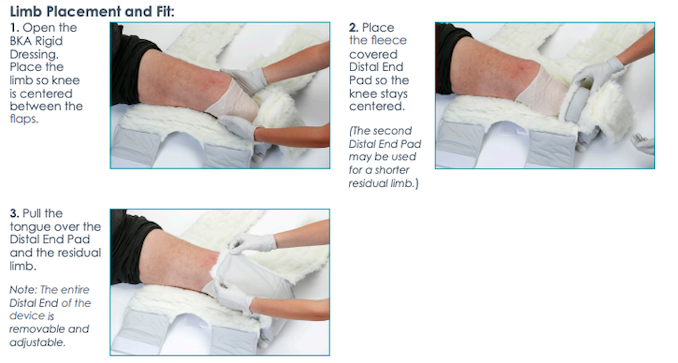 Pisces Healthcare Solutions. BKA Rigid Dressing