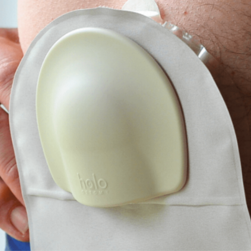 Picture of Halo Stoma Guard Kit