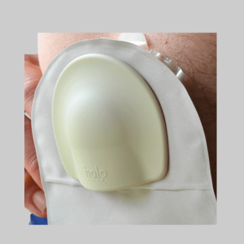 Picture of Halo Stoma Guard Kit