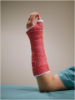Picture of Manosplint X-Lite Splinting Supplies