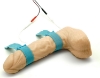 Picture of Circumferential Penile Electrodes